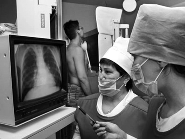 Рассматривая и «читая» снимки легких, врачи часто советуются с коллегами, чтобы не было ошибок.