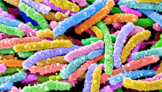 Весёленькие, разноцветные червячки — опаснейшие микроорганизмы, известные под названием «кишечные палочки». Фото strf.ru