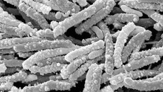 Весёленькие, разноцветные червячки — опаснейшие микроорганизмы, известные под названием «кишечные палочки». Фото strf.ru