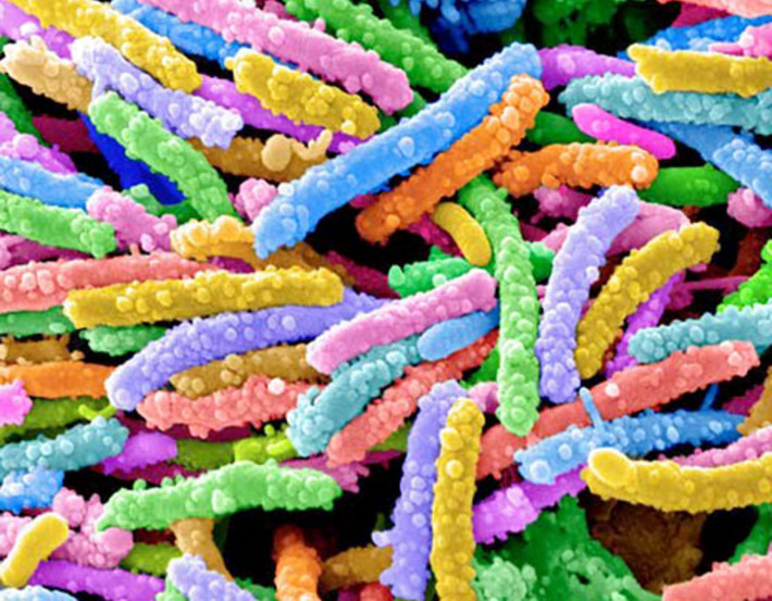 Весёленькие, разноцветные червячки — опаснейшие микроорганизмы, известные под названием «кишечные палочки». Фото strf.ru