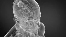 Фото предоставлено Национальным медицинским исследовательским центром им. Мешалкина